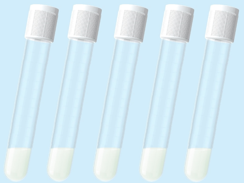Medical nucleic acid test tube